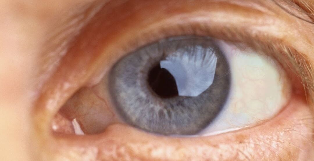 remédios para disfunção erétil podem aumentar o risco de doenças oculares