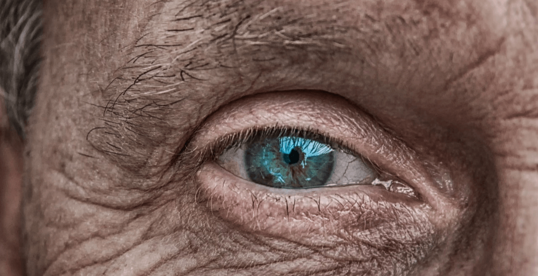 nova tecnologia para glaucoma