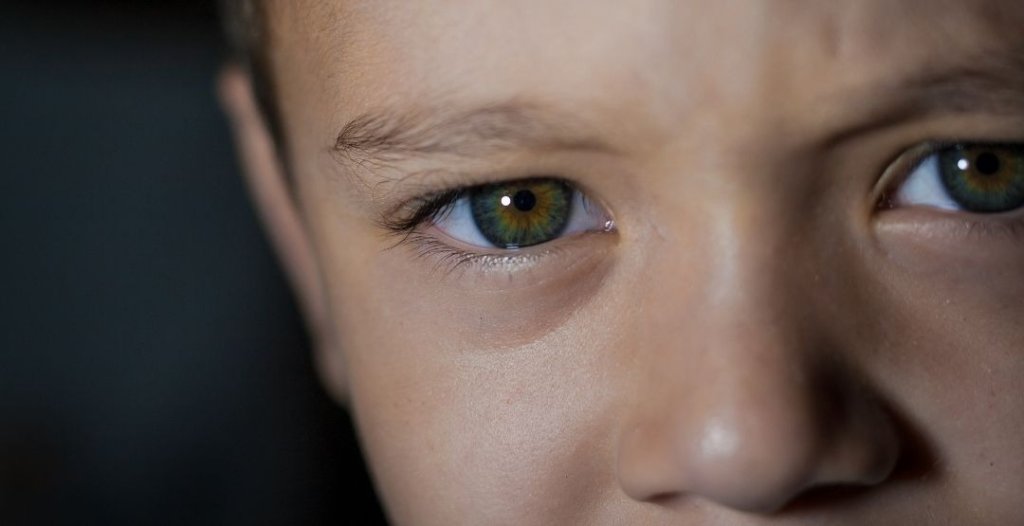 alergia ocular em crianças e adolescentes