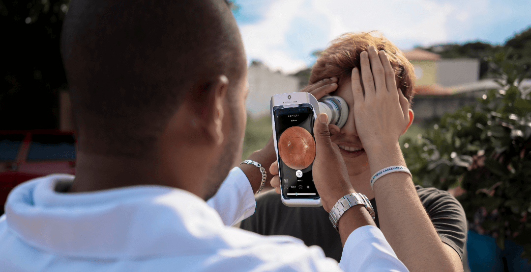 Connected to a smartphone, Eyer handheld fundus camera offers high quality images at an affordable cost