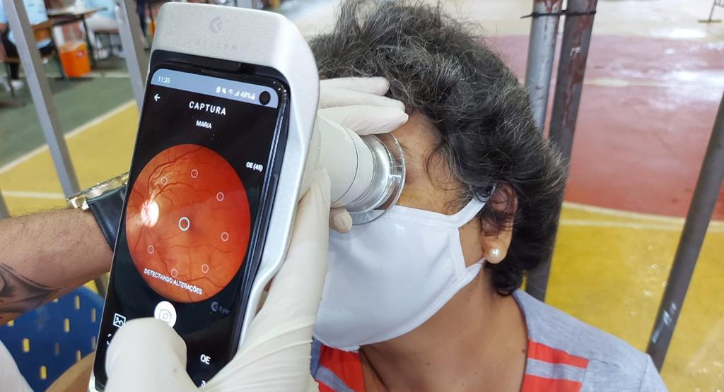 Eyer: mais de 500 mil pessoas tem acesso à exames de retina com aparelho portátil