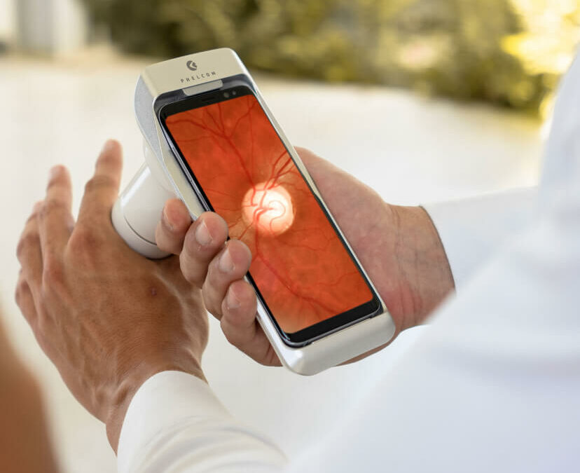 Eyer é lançado no Japão