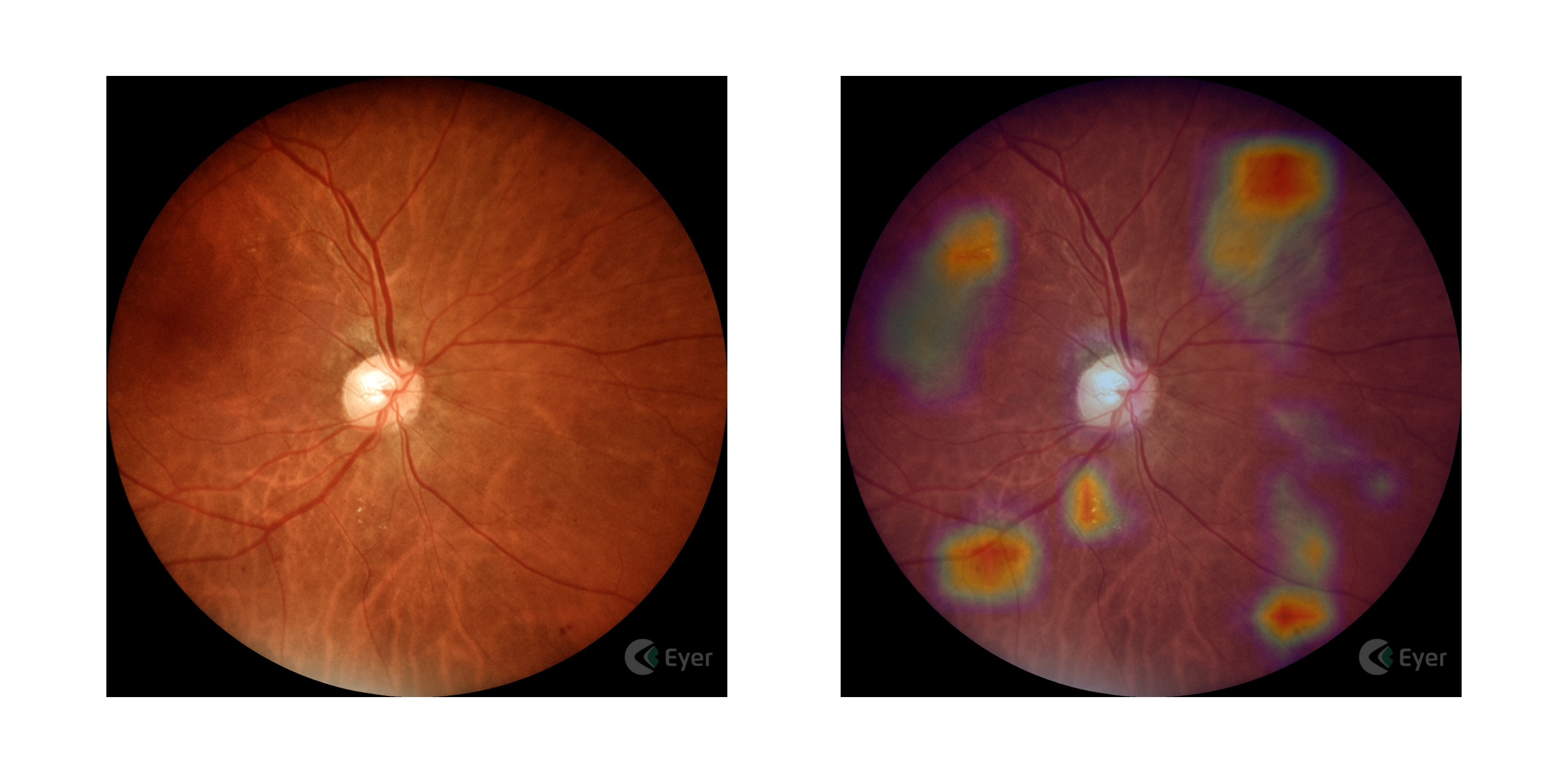 CAPV Optometria - Muitas doenças afetam a região dos olhos