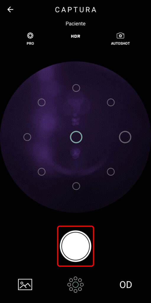 Faq Como Realizar Captura Com Macula No Centro Da Foto 2 1
