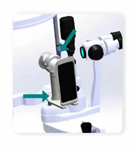 Faq How To Use The Eyer In A Slit Lamp 05