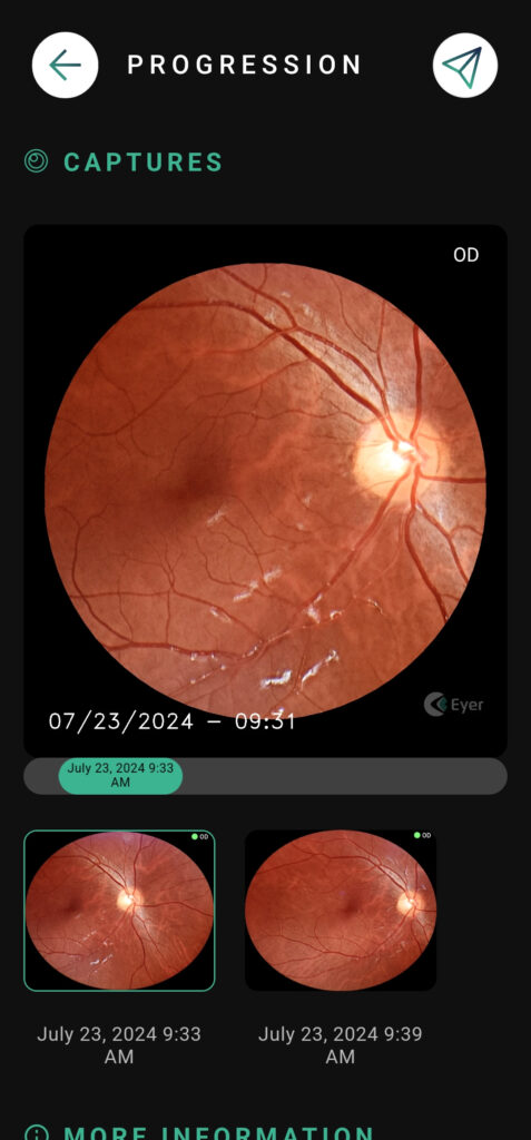 Help Patient Progression 04