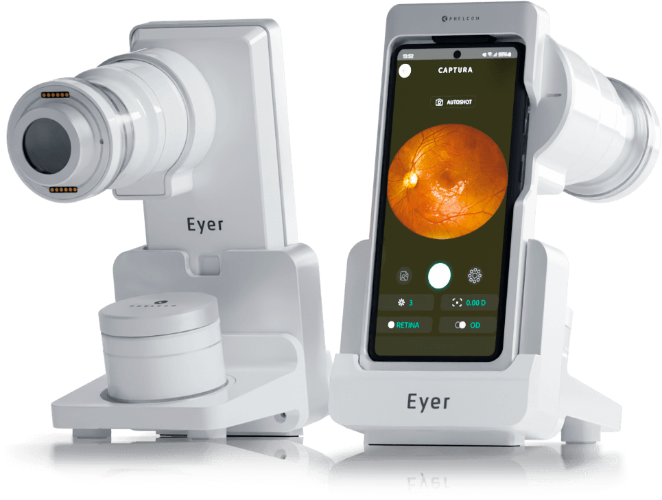 Simulador Eyer2