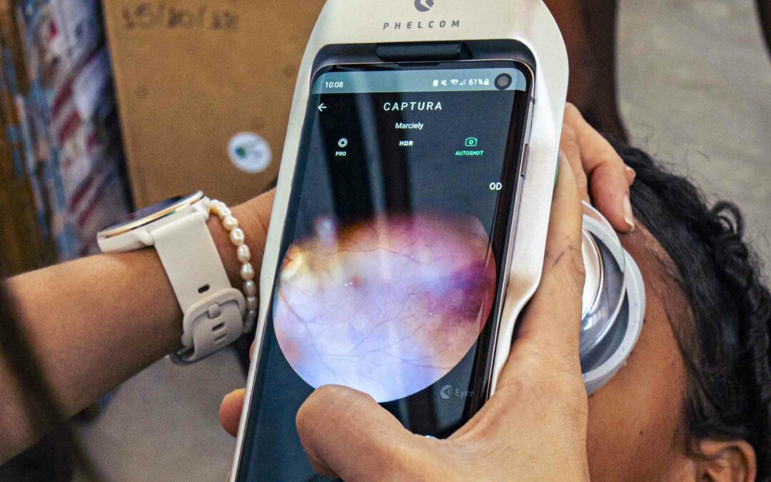 Com Eyer, ONG Doutores do Mundo amplia exames e diagnósticos oftalmológicos