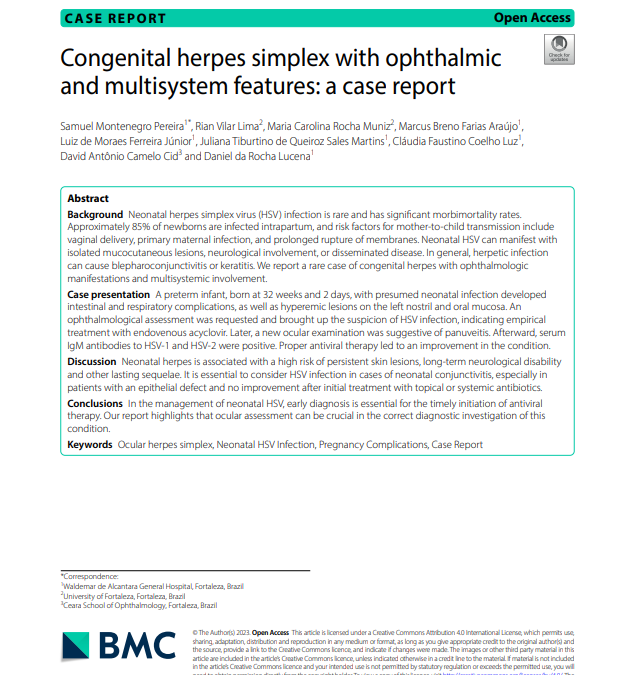 Congenital herpes simplex with ophthalmic and multisystem features: a case report