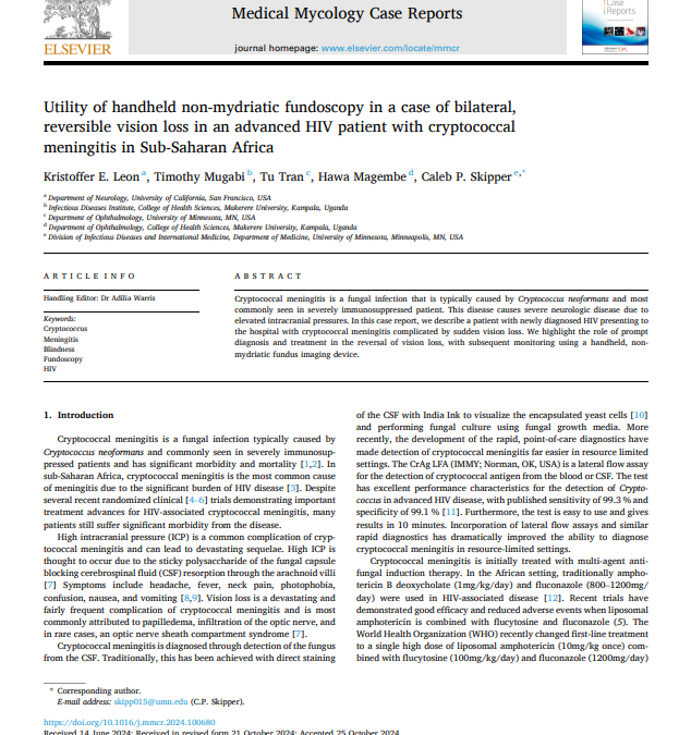 Utility of handheld non-mydriatic fundoscopy in a case of bilateral, reversible vision loss in an advanced HIV patient with cryptococcal meningitis in Sub-Saharan Africa