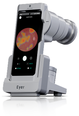 Img Eyermaps Device