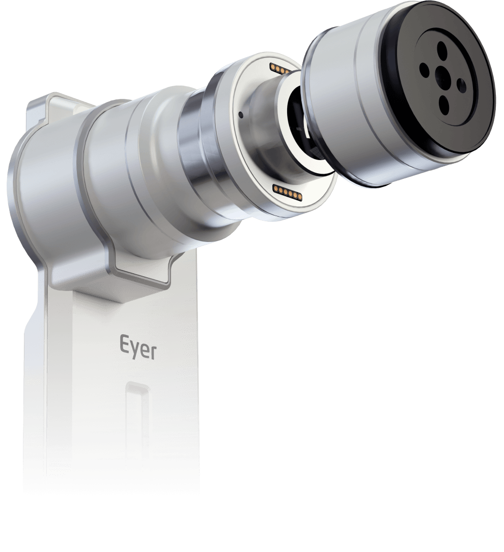 Eyer2 fundus camera, it's that simple.