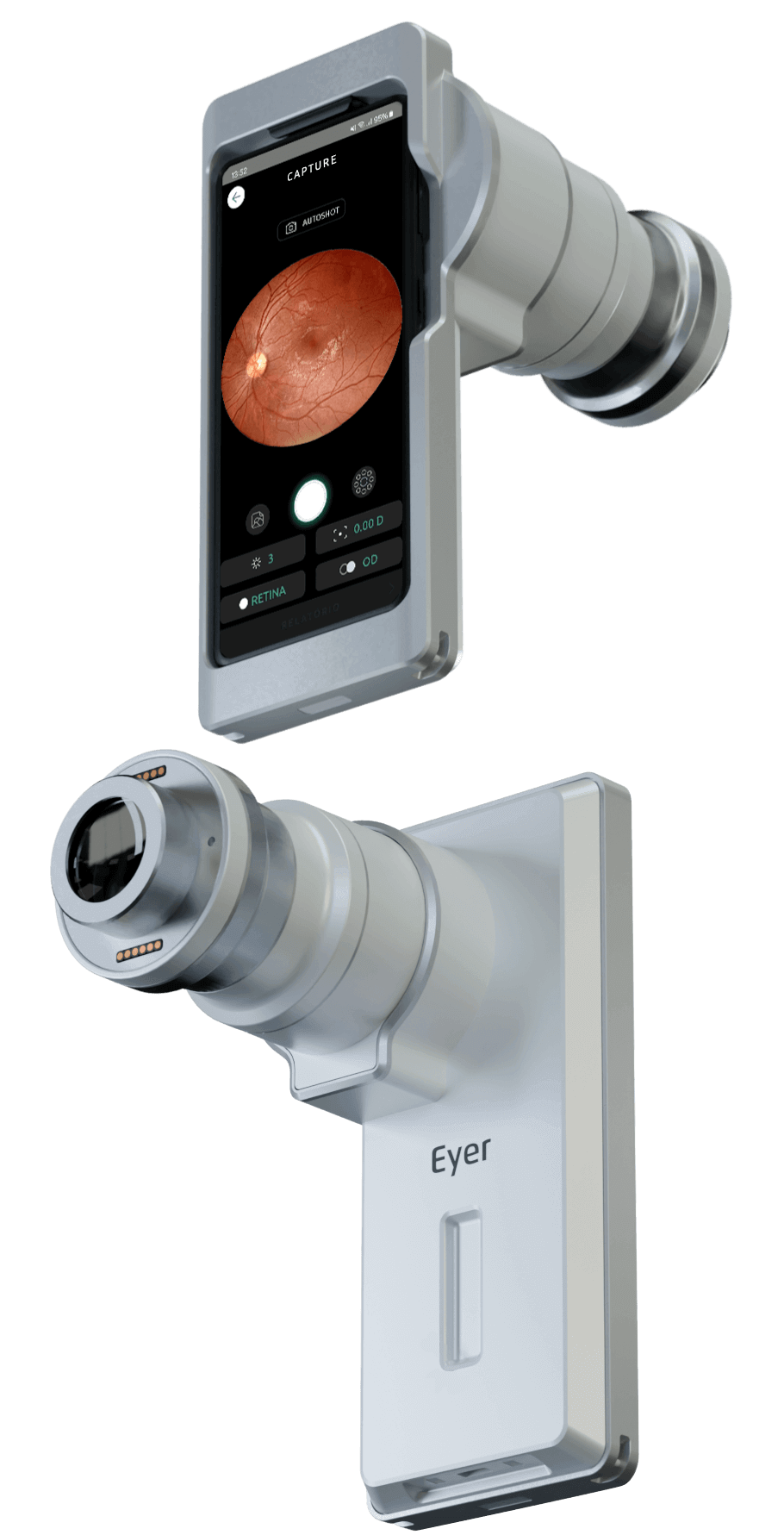 Eyer2 fundus camera specifications