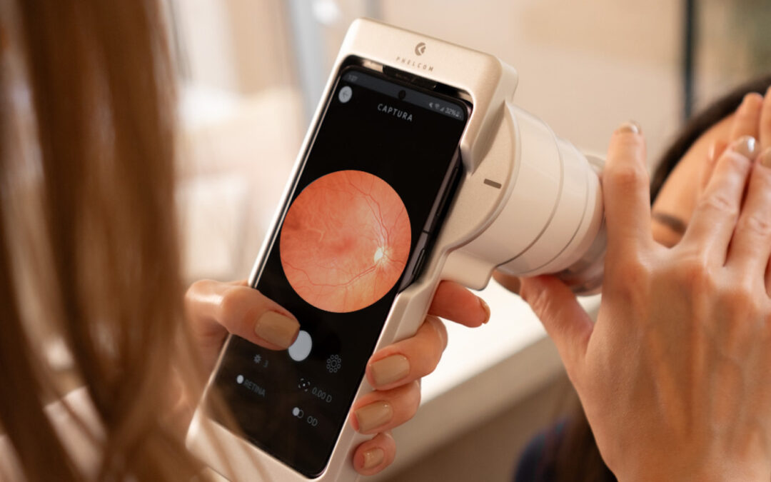 O oftalmoscópio na era digital: o poder da fotodocumentação com retinógrafo