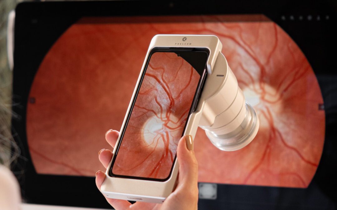 The Retinoscope and the Retina: Bridging Function and Structure for Diagnostic Excellence