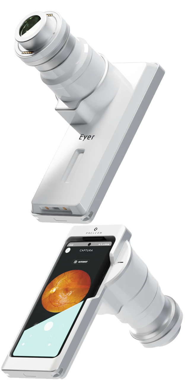 Eyer2 fundus camera specifications