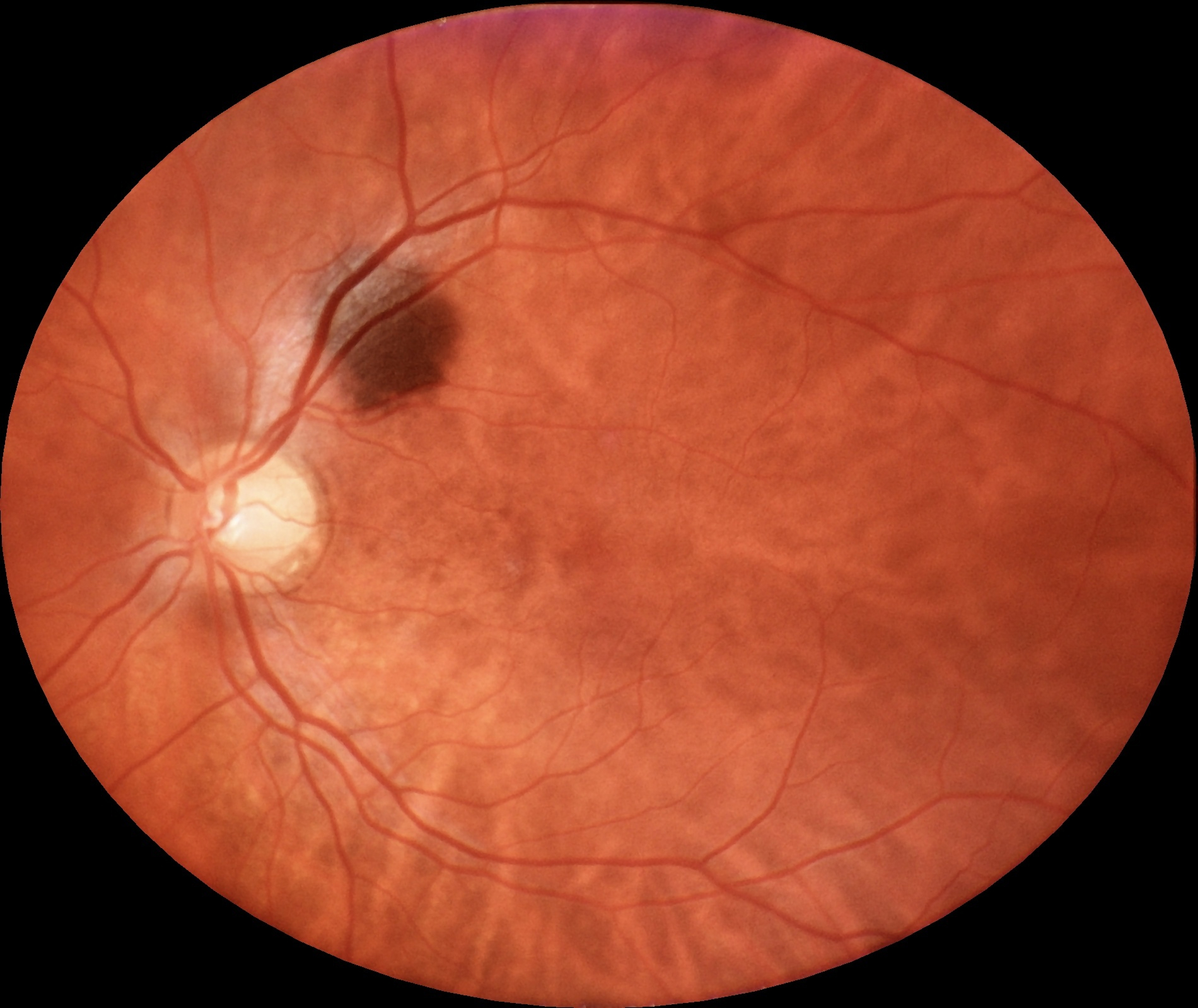 eyer2_image_example_001