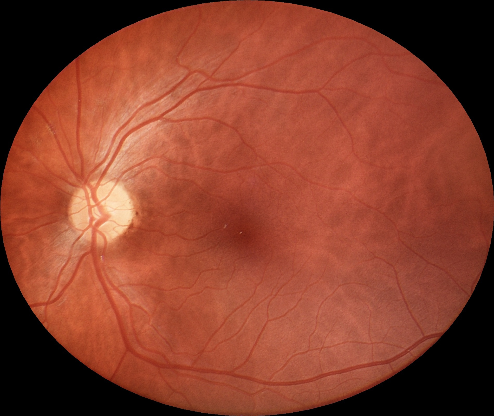eyer2_image_example_002