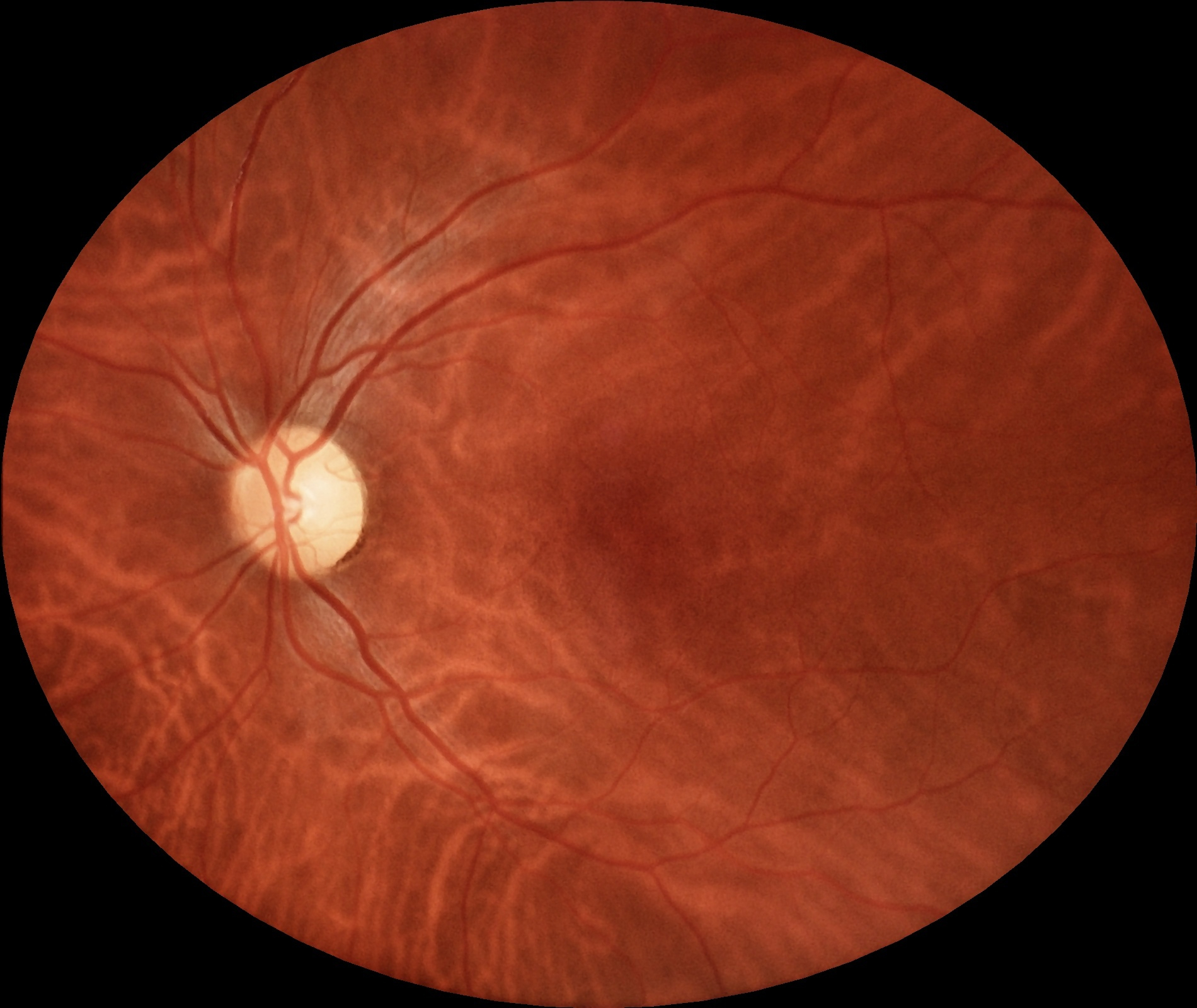eyer2_image_example_003