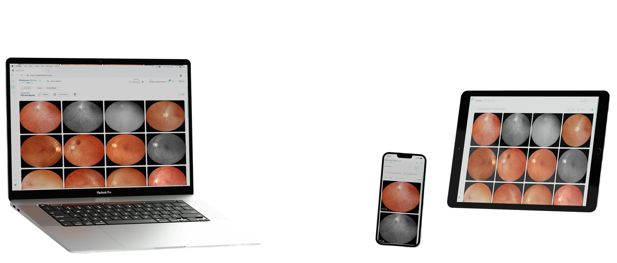 Eyercloud Eyer2 Essential Fundus Camera