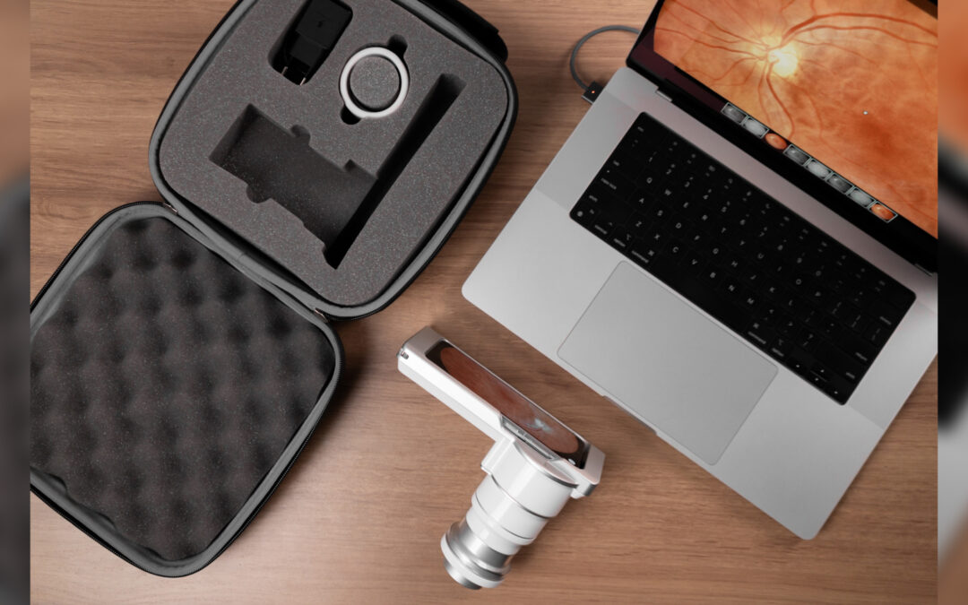 Phelcom lança Eyer2 Essential focado em exames de retina e alta portabilidade